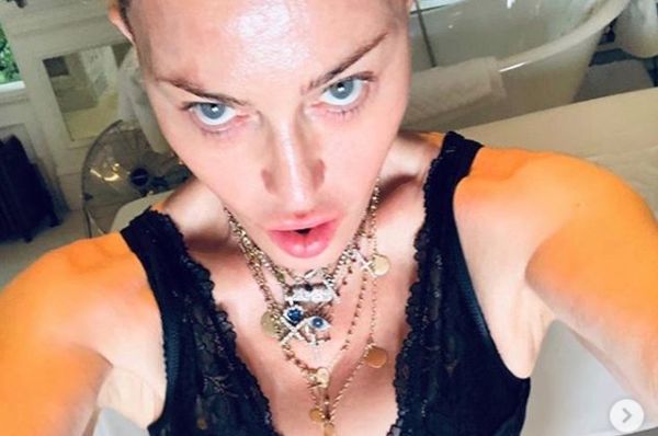 Madonna “Mi sottoporro’ a un intervento di medicina rigenerativa”