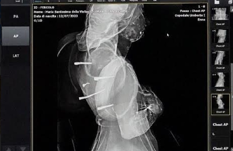 Statua di Maria, radiografia del fercolo, “servirà per il restauro”